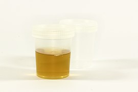 urine detection time